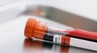 Oddaj próbkę krwi w Staszicu - możesz być dawcą szpiku kostnego