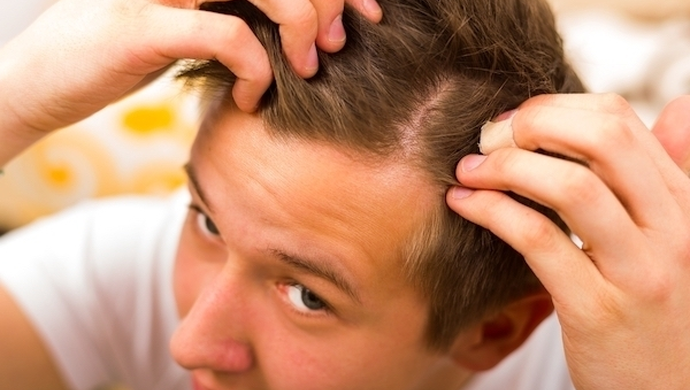 Jak radzić sobie z nadmiernym wypadaniem włosów?