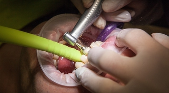 Czym jest skaling i kiedy warto z niego skorzystać?