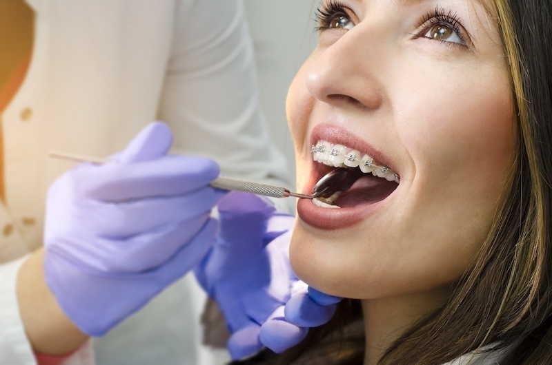 O co warto zapytać podczas pierwszej wizyty u nowego dentysty