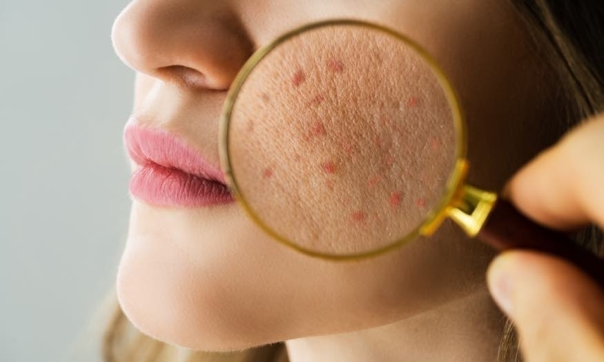 Dermatolog w Krakowie Twoja Skóra w Bezpiecznych Rękach
