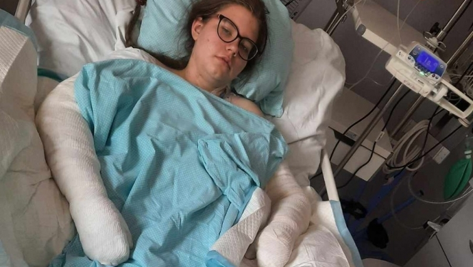 Pomoc dla Agaty Borowskiej - apel o wsparcie dla młodej wolontariuszki po tragicznym wypadku