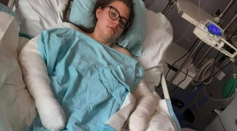 Pomoc dla Agaty Borowskiej - apel o wsparcie dla młodej wolontariuszki po tragicznym wypadku