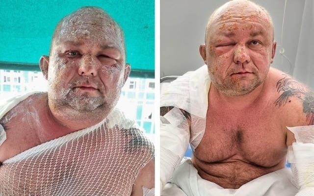 Wystartowała zbiórka dla Łukasza. Prosiłem żonę żeby uciekała z naszymi dziećmi