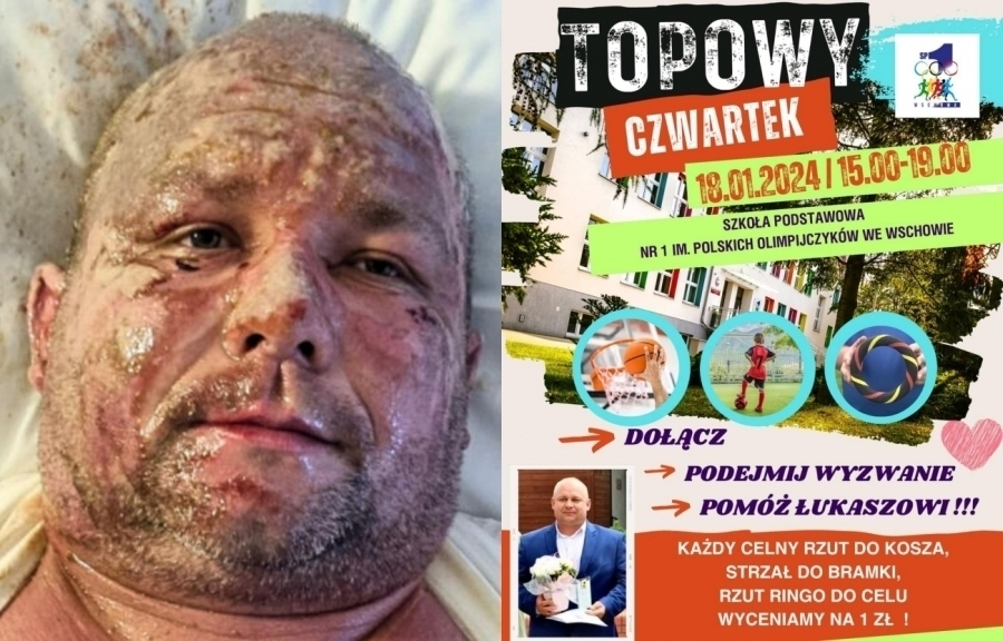Przyjdź i pomóżŁukaszowi Topie. SP 1 organizuje Topowy Czwartek
