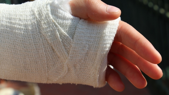 Wypożyczenie sprzętu medycznego Exogen a leczenie złamań