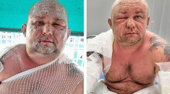 Wystartowała zbiórka dla Łukasza. „Prosiłem żonę, żeby uciekała z naszymi dziećmi”