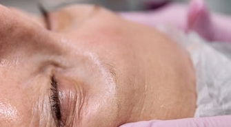 Jaki laser na zmarszczki wybrać?