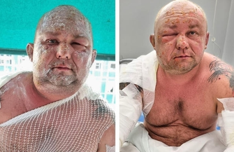 Wystartowała zbiórka dla Łukasza. Prosiłem żonę żeby uciekała z naszymi dziećmi