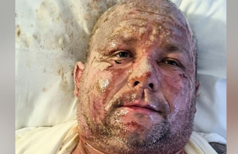 Wystartowała zbiórka dla Łukasza. Prosiłem żonę żeby uciekała z naszymi dziećmi